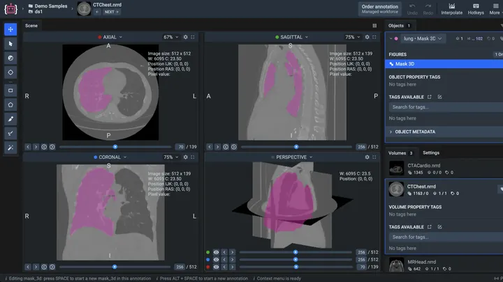 The Supervisely DICOM labeling toolbox: a chest CT volume with a lung segmented in the axial, sagittal, coronal and 3D views