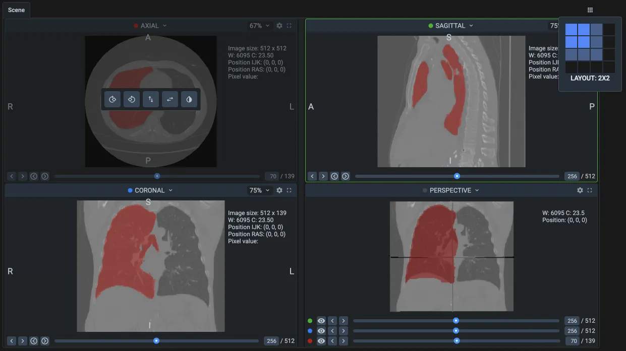 The four views of the Supervisely DICOM toolbox with a segmented lung, the view settings of the axial view and the layout picker set to 2 by 2
