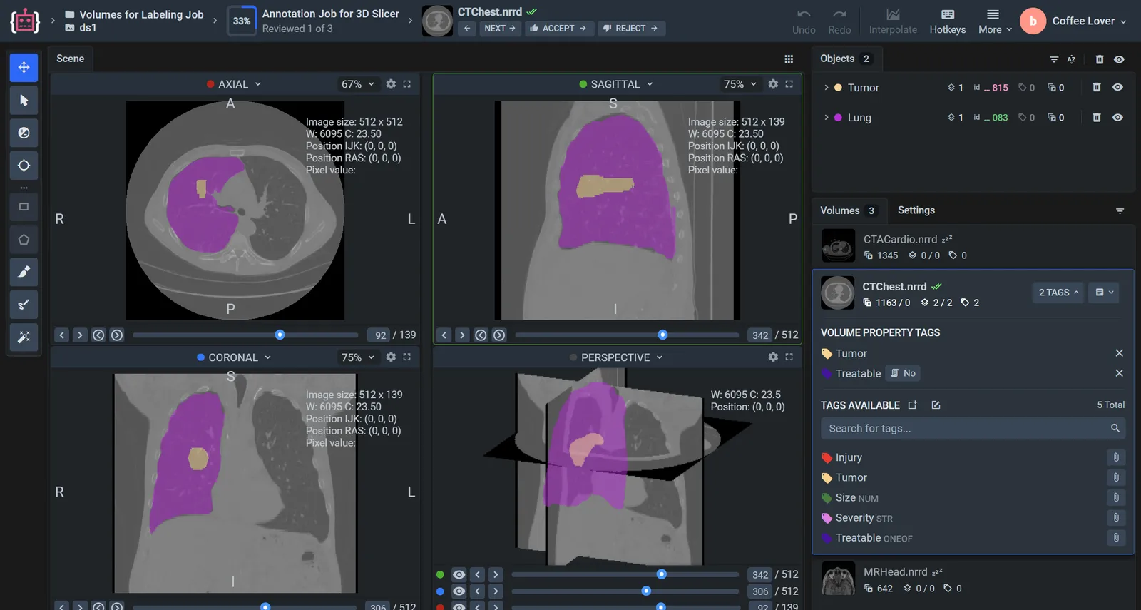 A reviewer in the Supervisely DICOM toolbox, with the Accept and Reject buttons of a labeling job next to the volume name